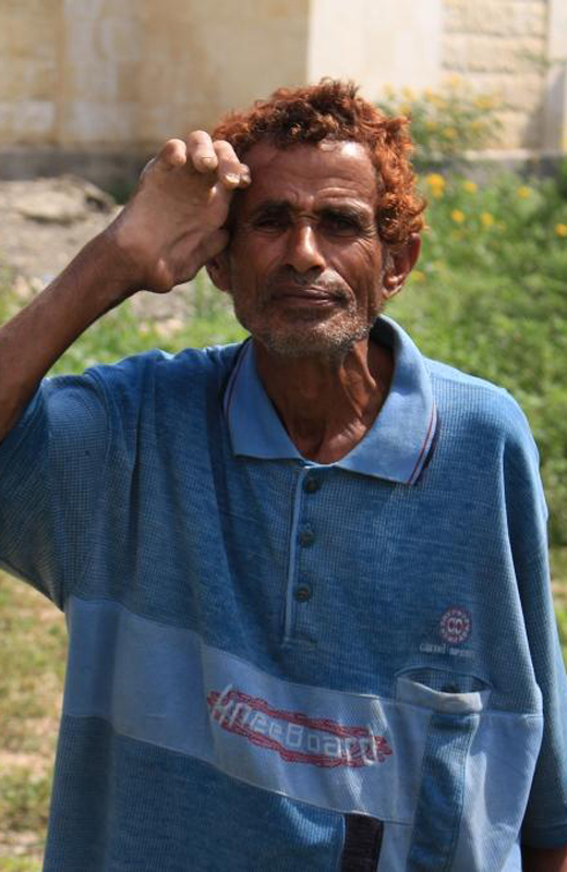 Qasim al-Salahi says he blames the Yemeni government and Saudi-led coalition for his plight [Mohammed Al-Rumim/Al Jazeera]