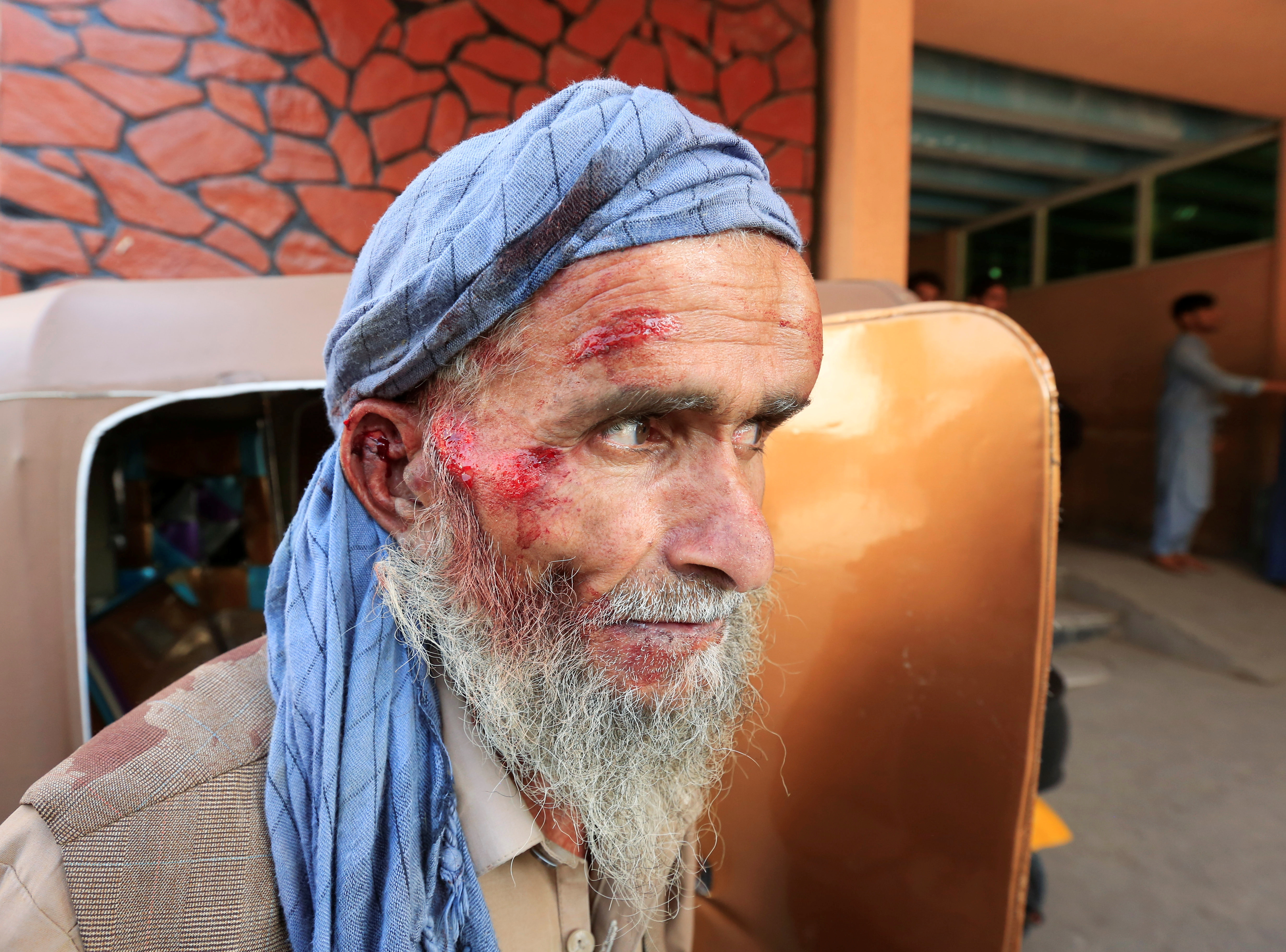 An Afghan man who got injured while collecting tokens needed to apply for Pakistan visa