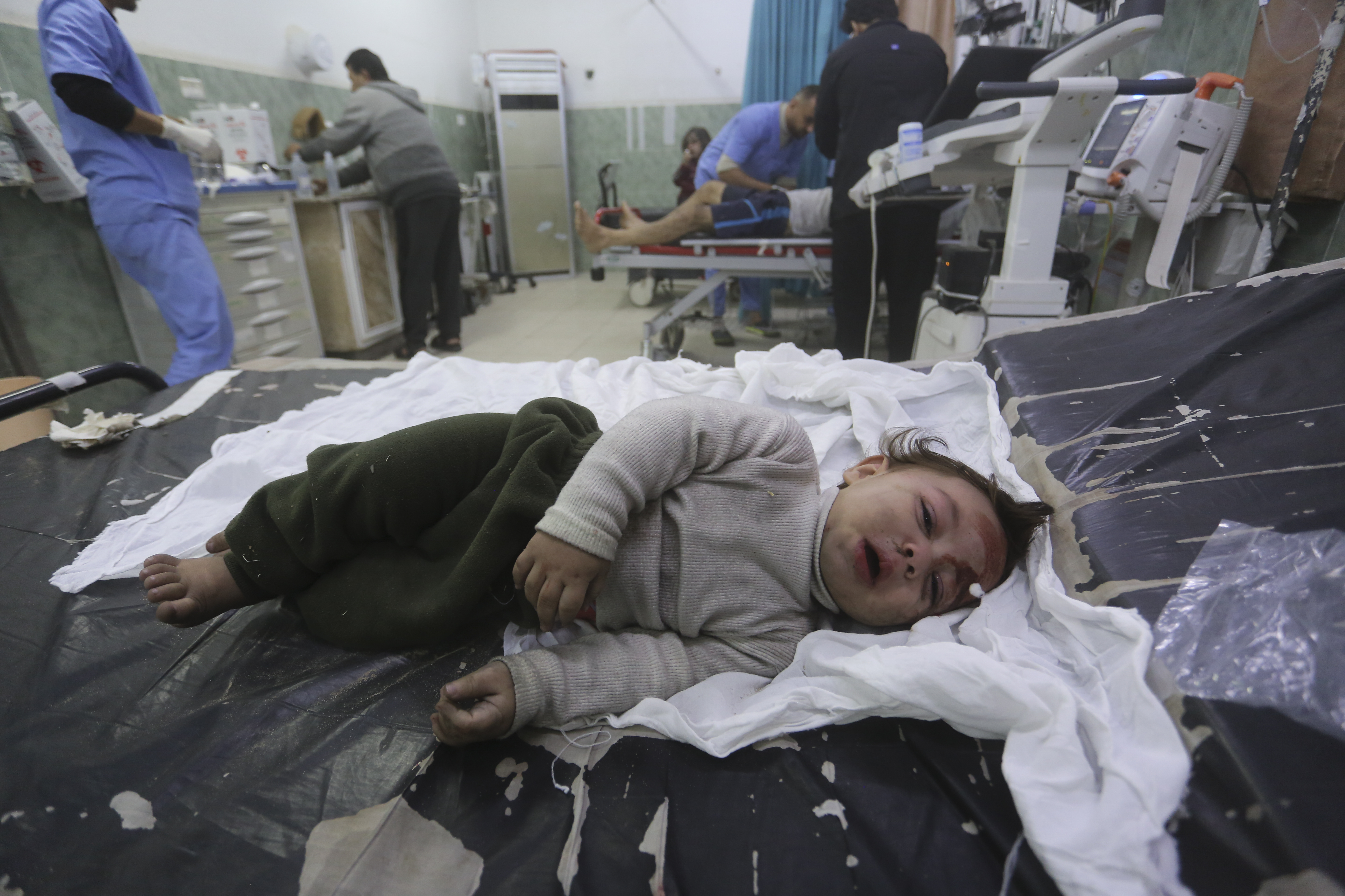 A Palestinian child wounded in the Israeli bombardment of the Gaza Strip is brought to a hospital in Rafah