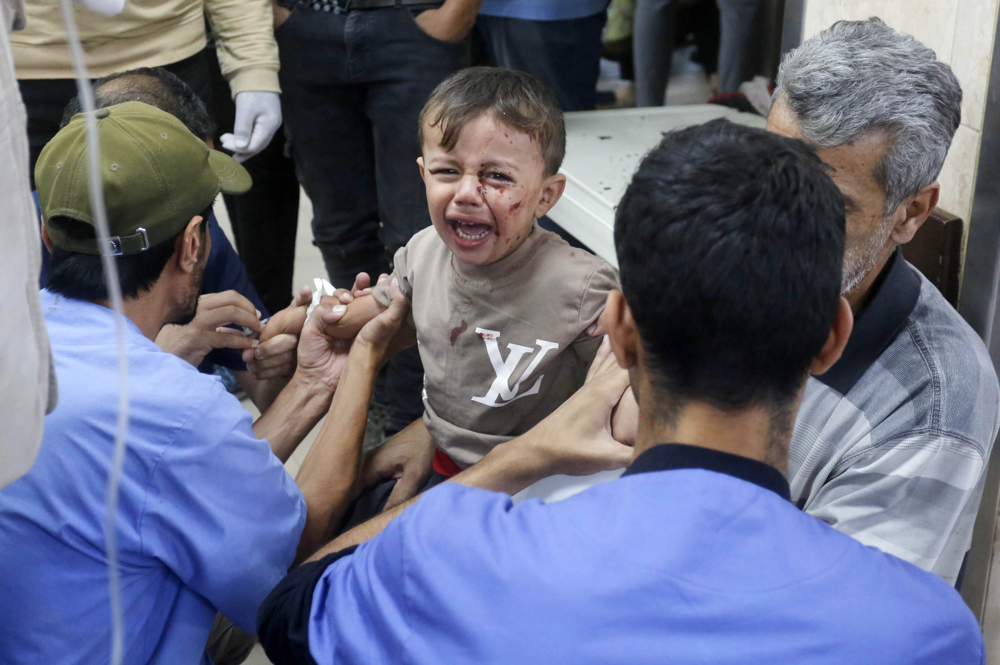 An injured child is treated at hospital