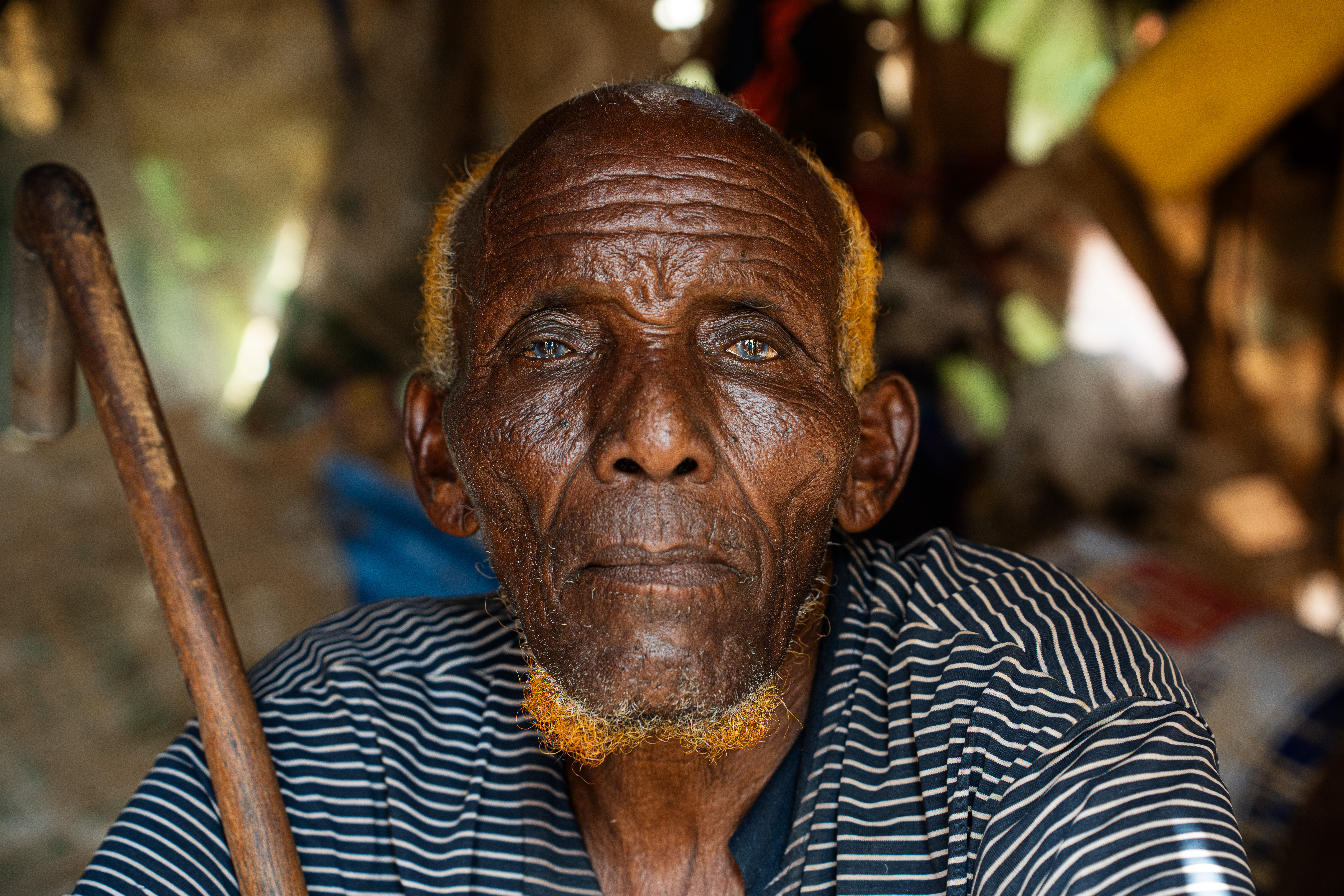 Ibrahim Ebdow, 83, is an elderly man with no children, fled the Bakool region alongside neighbours after losing more than 40 goats to the drought: his entire livelihood. With no family to support him, he had no choice but to leave. He now depends on the kindness of others to survive each day at Wayamo camp. "I lost everything," he says. "I only hope for some help to survive and live with dignity." Wayamo displacement camp, Baidoa, Southwest State, Somalia. [Abdulkadir Mohamed/NRC]